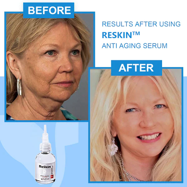 ReSkin Daily Advanced Deep Anti-wrinkle Serum