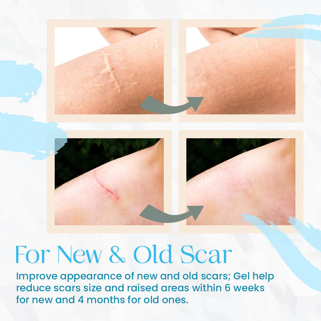 Organic Scar Removing Gel