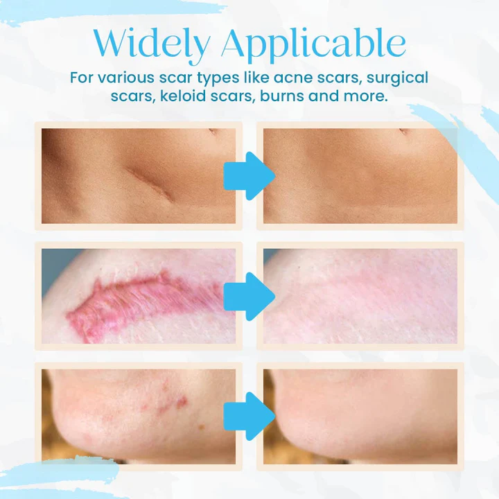 PureFade Advance Organic Scar Removing Gel