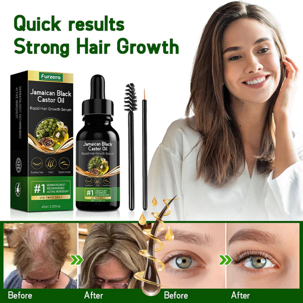 Furzero Jamaican Black Castor Oil Rapid Hair Growth Serum