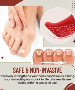 FeetFree Nail Anti-Fungus Socks