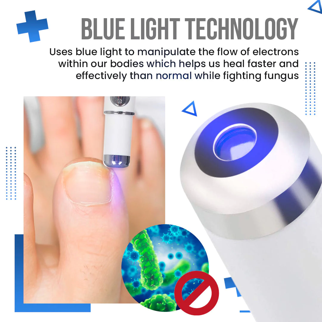 Suptruck Anti Fungus Blue Light Laser Pen