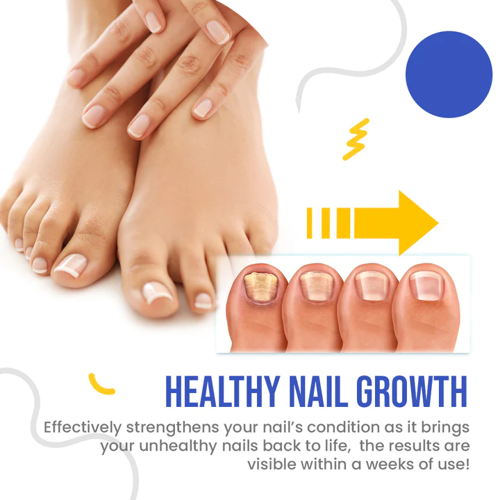 NailSpeed Light Cure Fungal Nail Pen