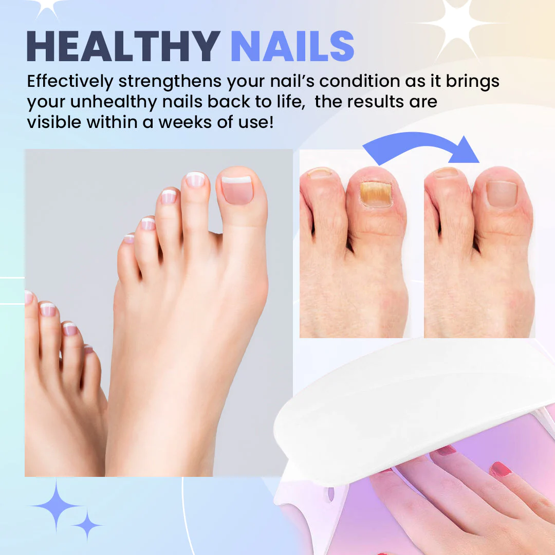 NailPro Nail Fungus LED Light Therapy Device