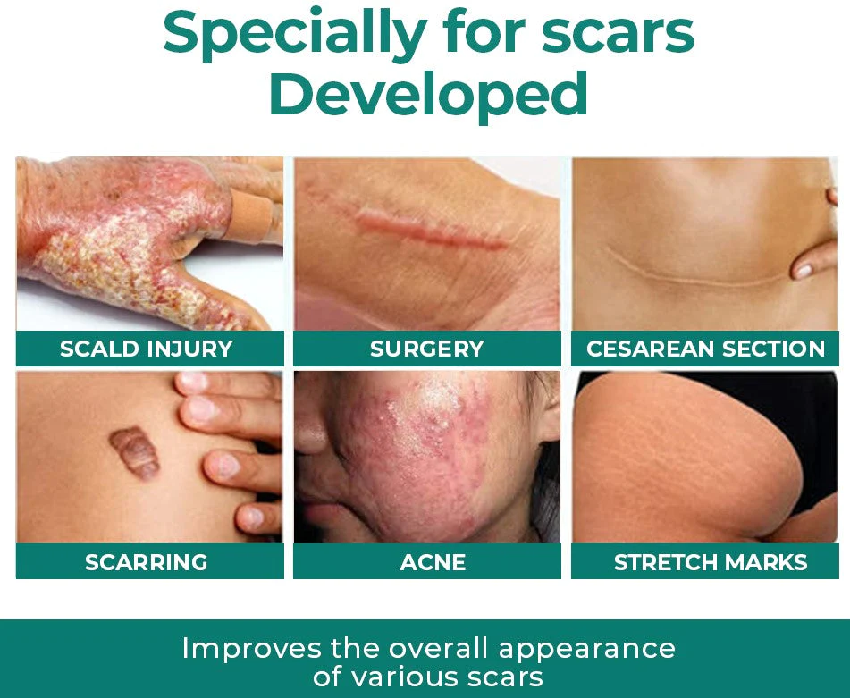 Furzero Advanced Medical-Grade Scar Gel With Stem Cells