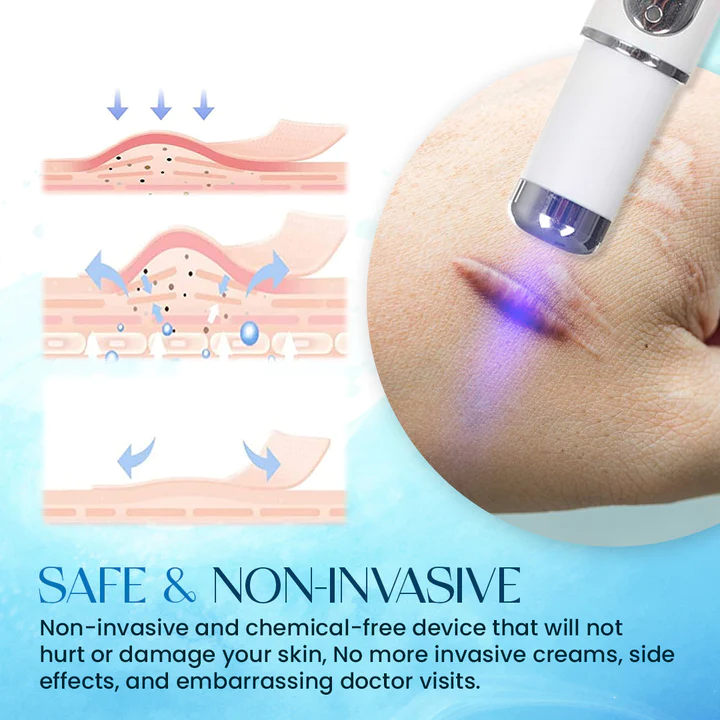 ScarErase UV Phototherapy Scar Removal Pen