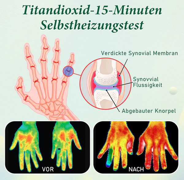 Sugoola Fern-Infrarot-Titan-Ionen-Arthritis-Therapie WĂ¤rme-Kompressionshandschuhe