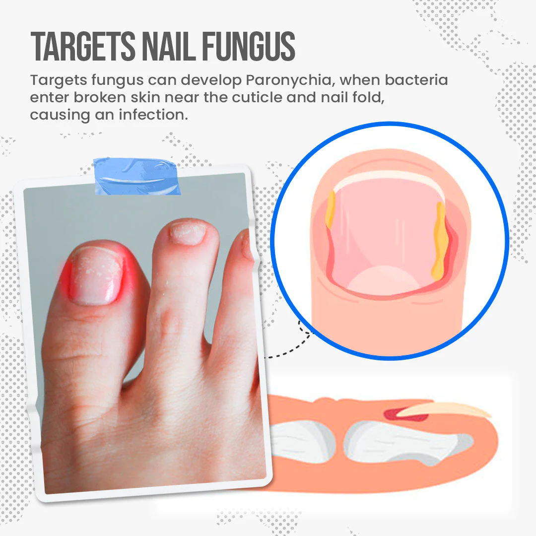 FungusShield Nail Fungus Treatment Cream