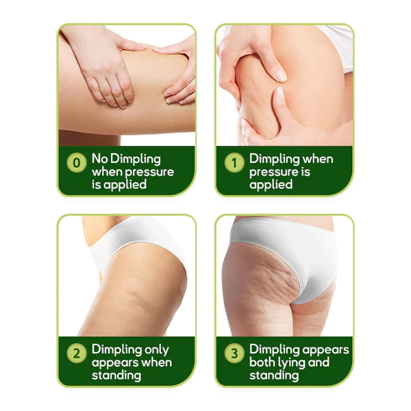 GFOUK MugwortsLegs Cellulite Reduction Patches