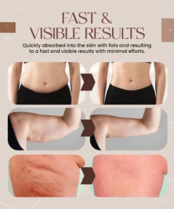 SlimVanish Fat-Melting Miracle Cream