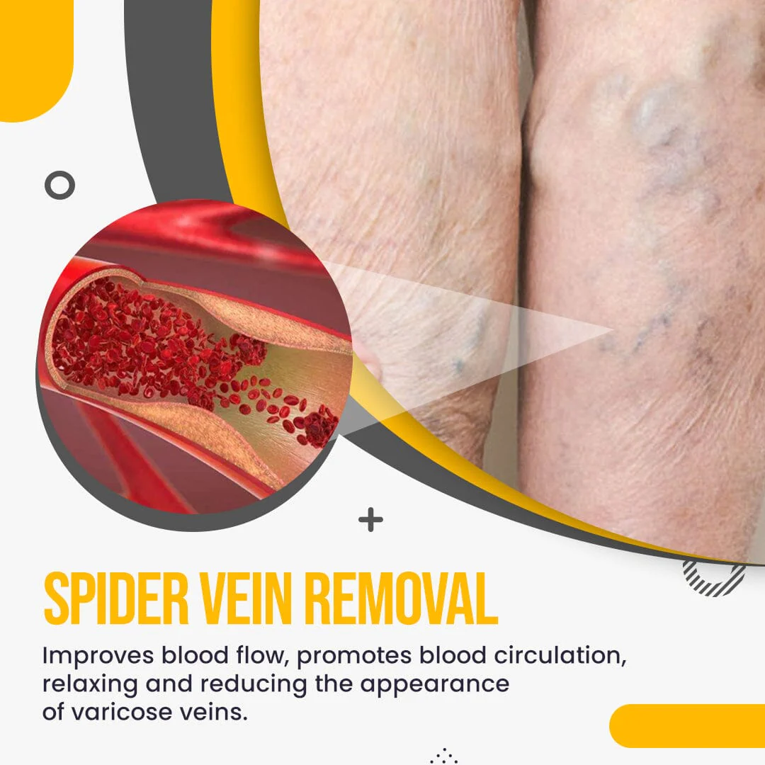 Raura Varicose Veins Treatment Patches