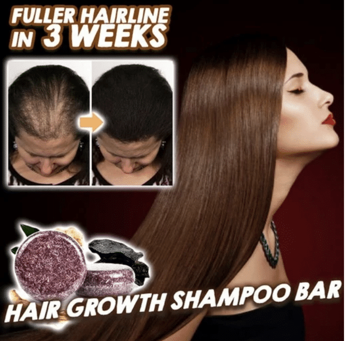 Hair Growth Shampoo Bar