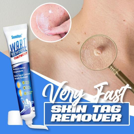 Very Fast Skin Tag Remover