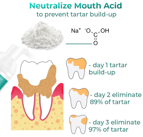 SmileMate Removal of Tartar and Plaque Bacteria and Various Oral Problems