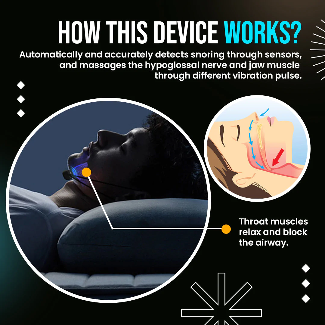 SleepRex Smart Anti Snoring Apnea Device