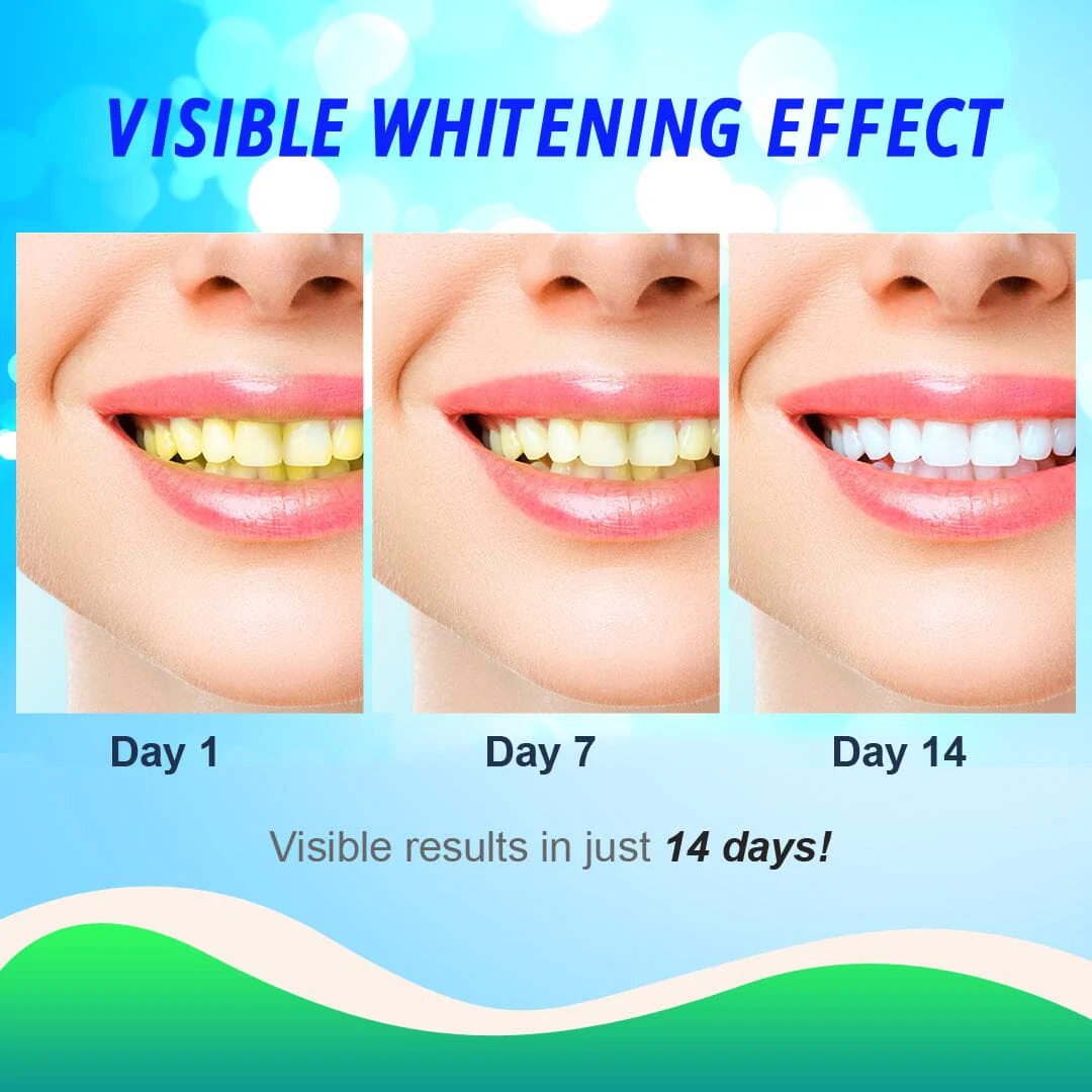 14 Days Teeth Whitening Strips