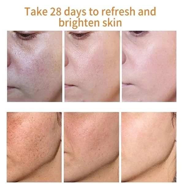 Vitamin C Freckle Dark Spot Removal Cream