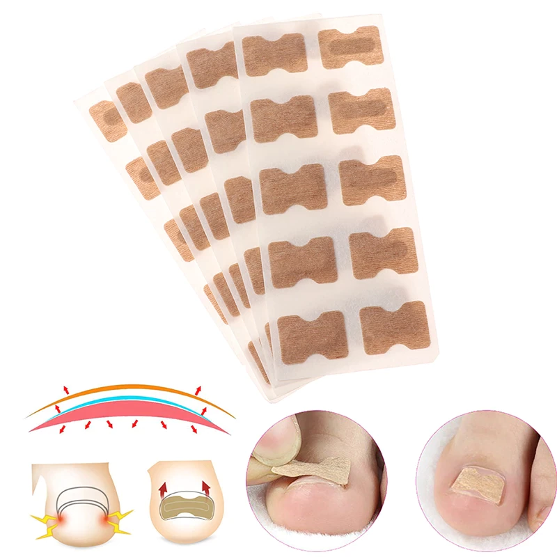 Toenail Corrector Patch (30 Pack)