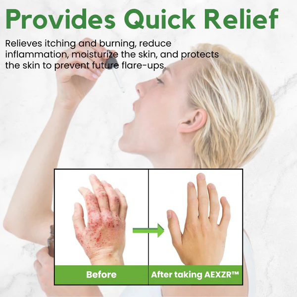 AEXZR Eczema Herbal Drops