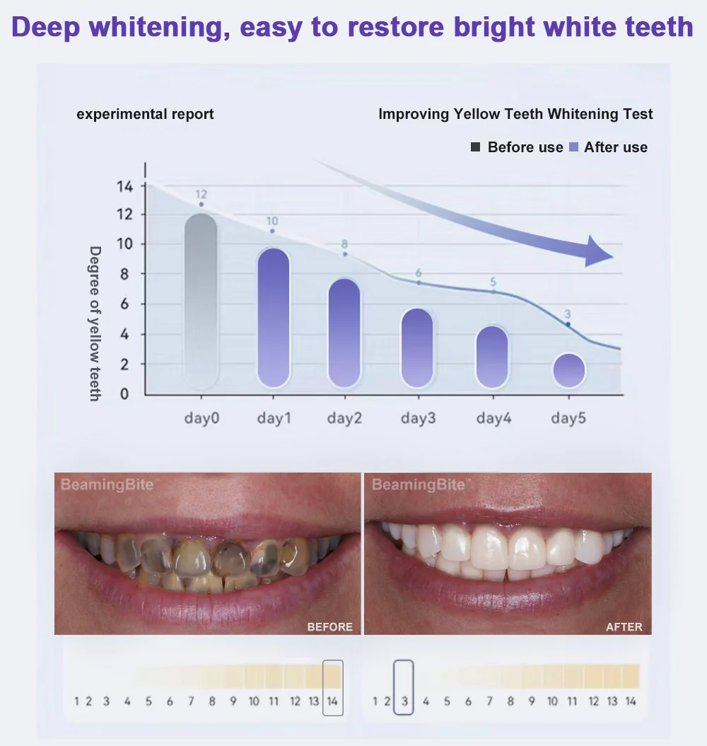 BeamingBite Whitening Mouthwash