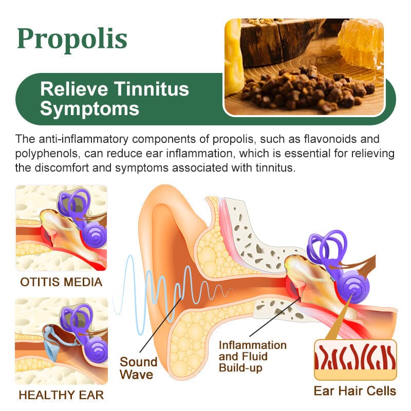 GFOUK Bee Propolis Tinnitus Soothing Spray