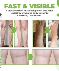 9-Pressure Points Insole