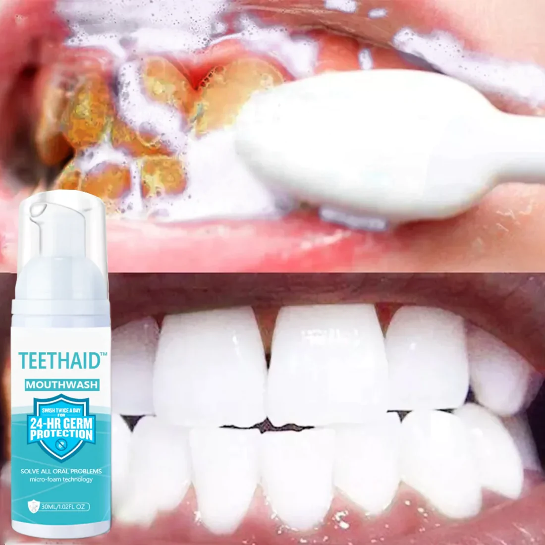 Teethaid Toothpaste  the comprehensive oral health solution for various oral problems, including tooth regeneration and maintenance