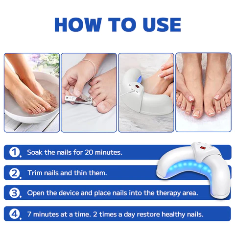 Furzero Fungal Nail Treatment Laser Device