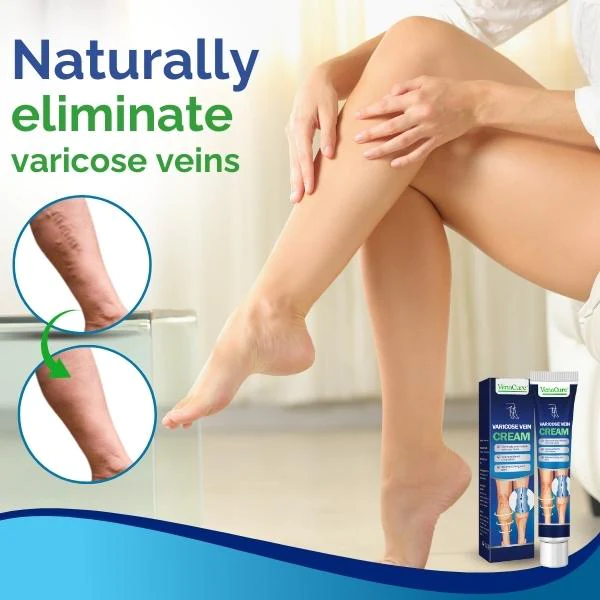 VenaCure Varicose Vein Cream