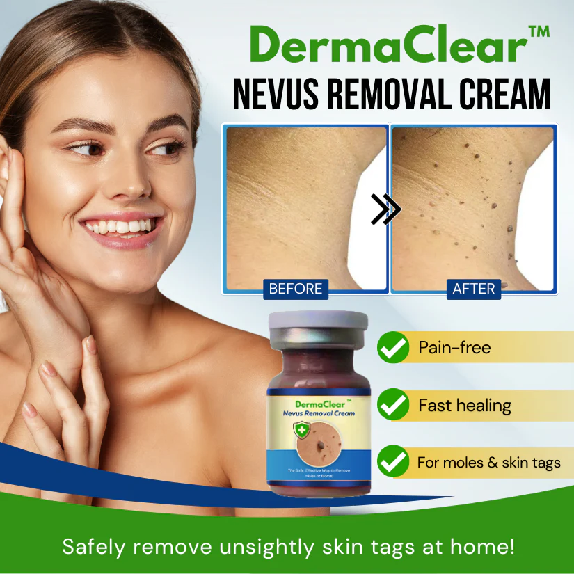 DermaClear Nevus Removal Cream