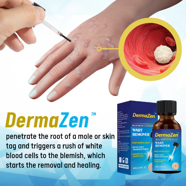 DermaZen Skin Tag Remover