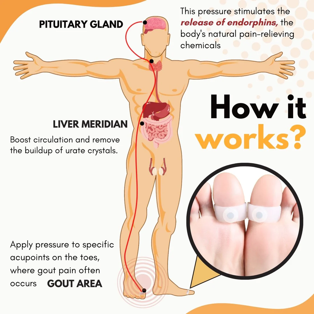 AcuHealth Gout Aid Toe Rings