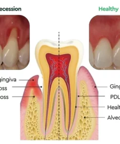 Daarsy Gums Regrowth Foam