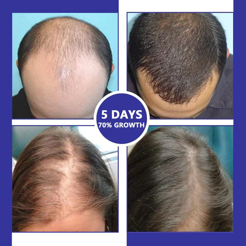 Unpree 7 Days Hair Growth Serum