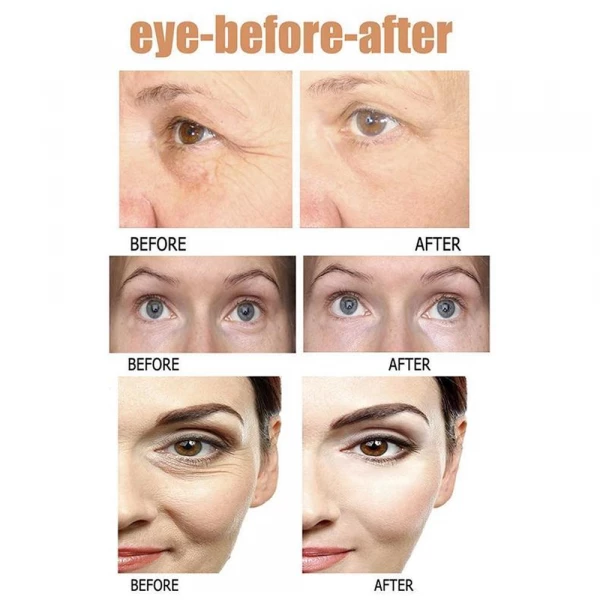 Eye Boost Serum