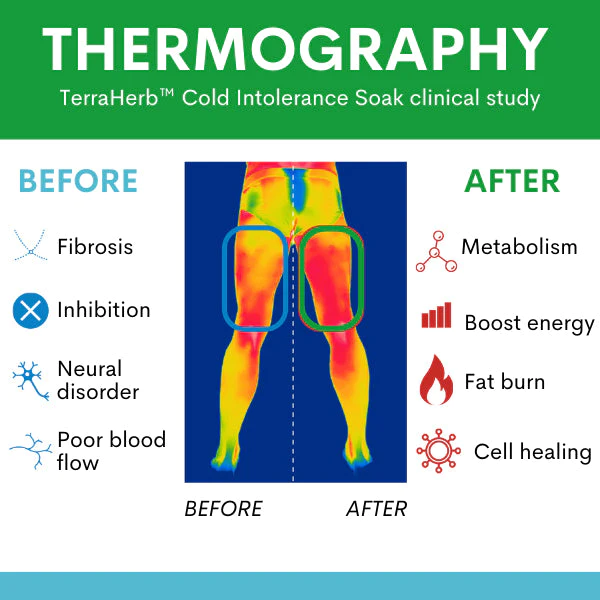 TerraHerb Cold Intolerance Soak