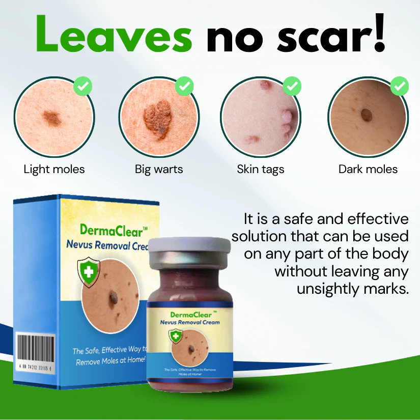 DermaClear Nevus Removal Cream