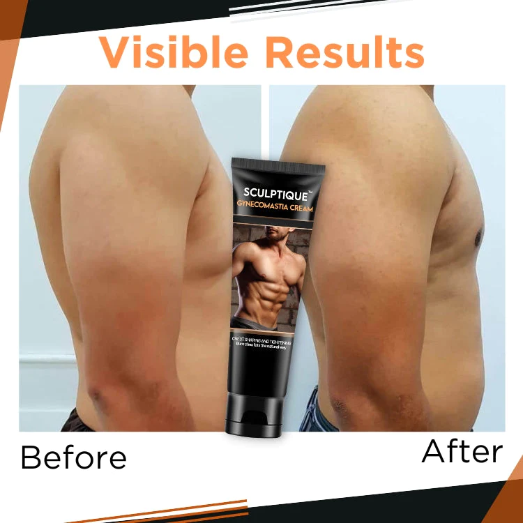 Sculptique Gynecomastia Cream