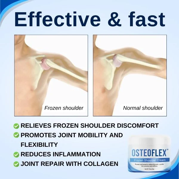 OsteoFlex Frozen Shoulder Cream