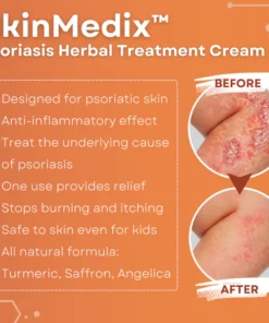 SkinMedix Psoriasis Herbal Treatment Cream