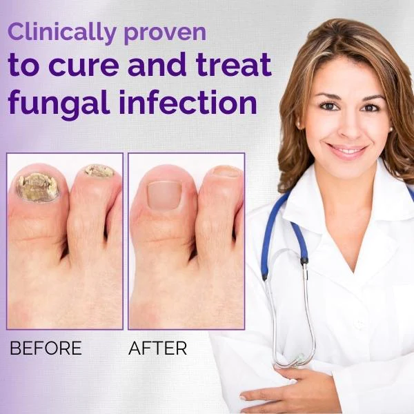 NailClear Nail Fungal Essence