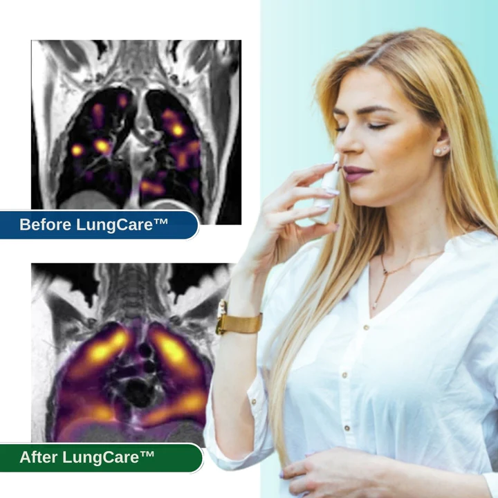 LungCare Cleanse & Repair Nasal Spray