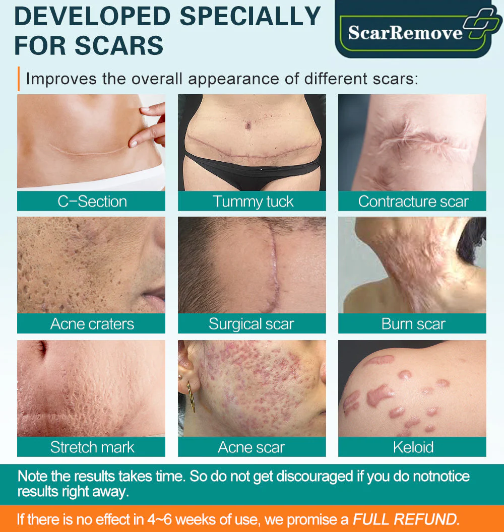 ProRegen Medical Scar Removal Spray