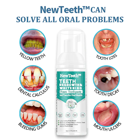 NewTeeth Toothpaste Mousse Foam  Calculus Removal, Teeth Whitening, Healing Mouth Ulcers, Eliminating Bad Breath, Preventing and Healing Caries, Tooth Regeneration