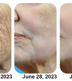 flysmus Graphene Anti-Wrinkle Mask