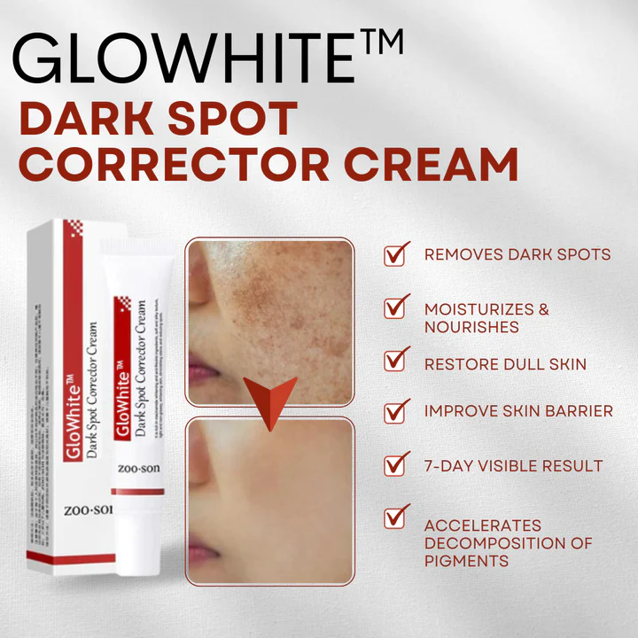 GloWhite Dark Spot Corrector Cream