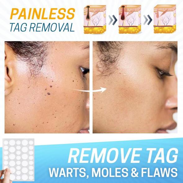 Skin Tag Pain-Free Remover Patch