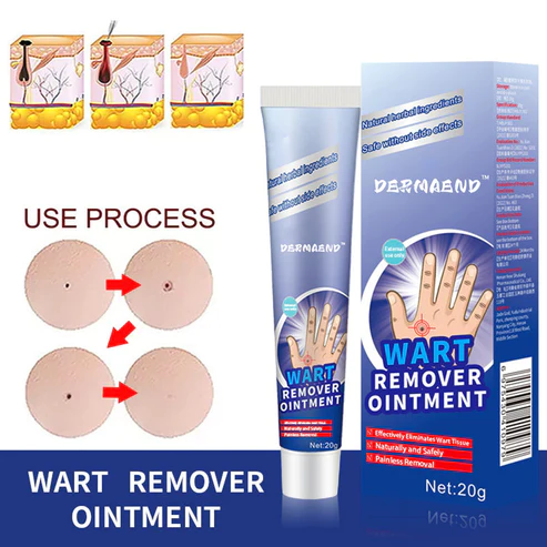 DermaEnd Wart Remover Herbal Ointment 100% Natural