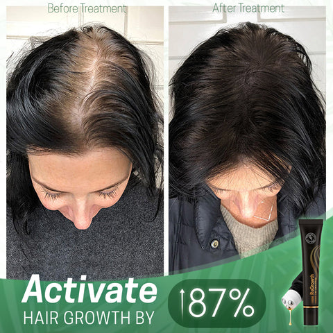 Unpree 7 Days Hair Growth Serum