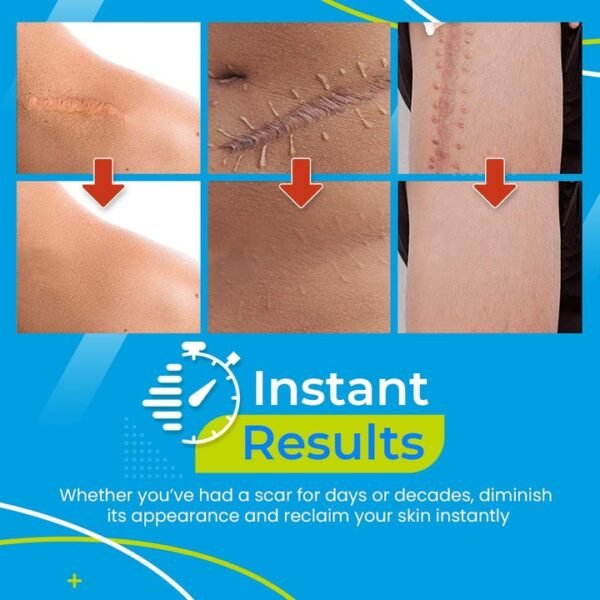 Scar Removal Gel Patch